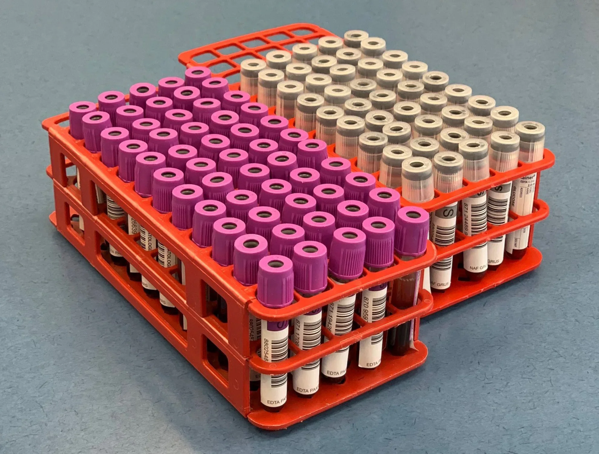 Bloedafnamebuizen in een lab, verwijzing naar EVO-IT’s transportplanning software voor zorglogistiek.